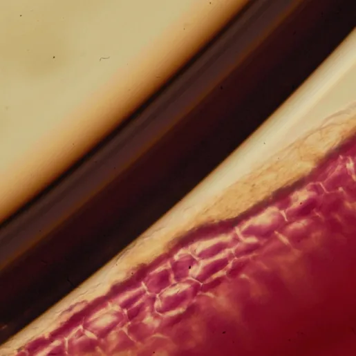 Vein close up